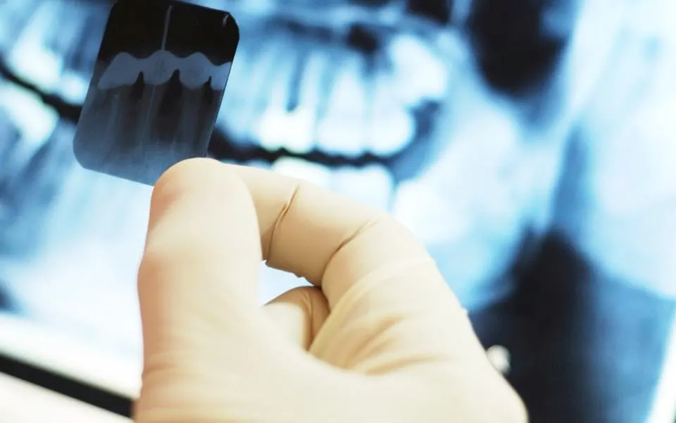 Radiografía periapical digital