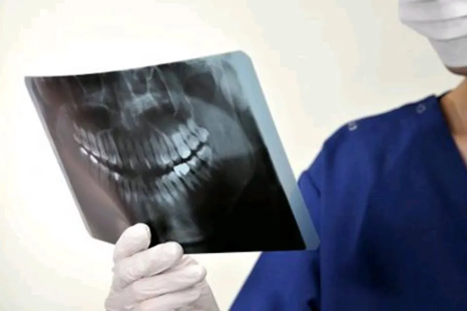 Radiografía dental digital