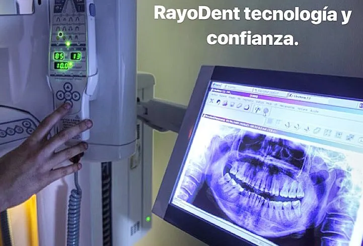 Tomografía en pantalla