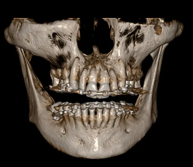 Tomografía dental